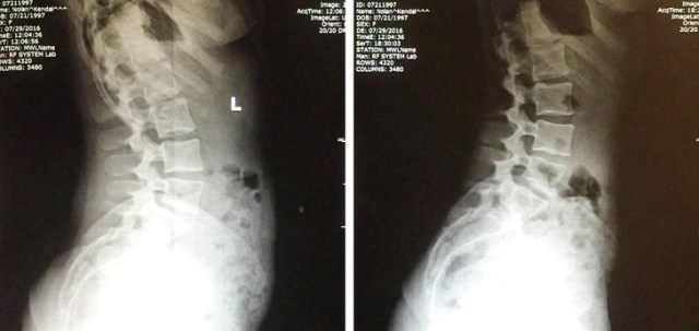 People Go Through 3 Periods When They Age Faster Than Usual